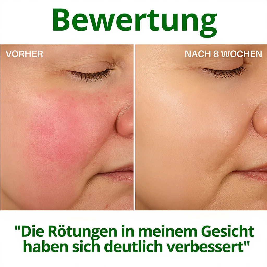 HYDROLUXE™ – Entfernt Chlor und Kalk aus deiner Dusche